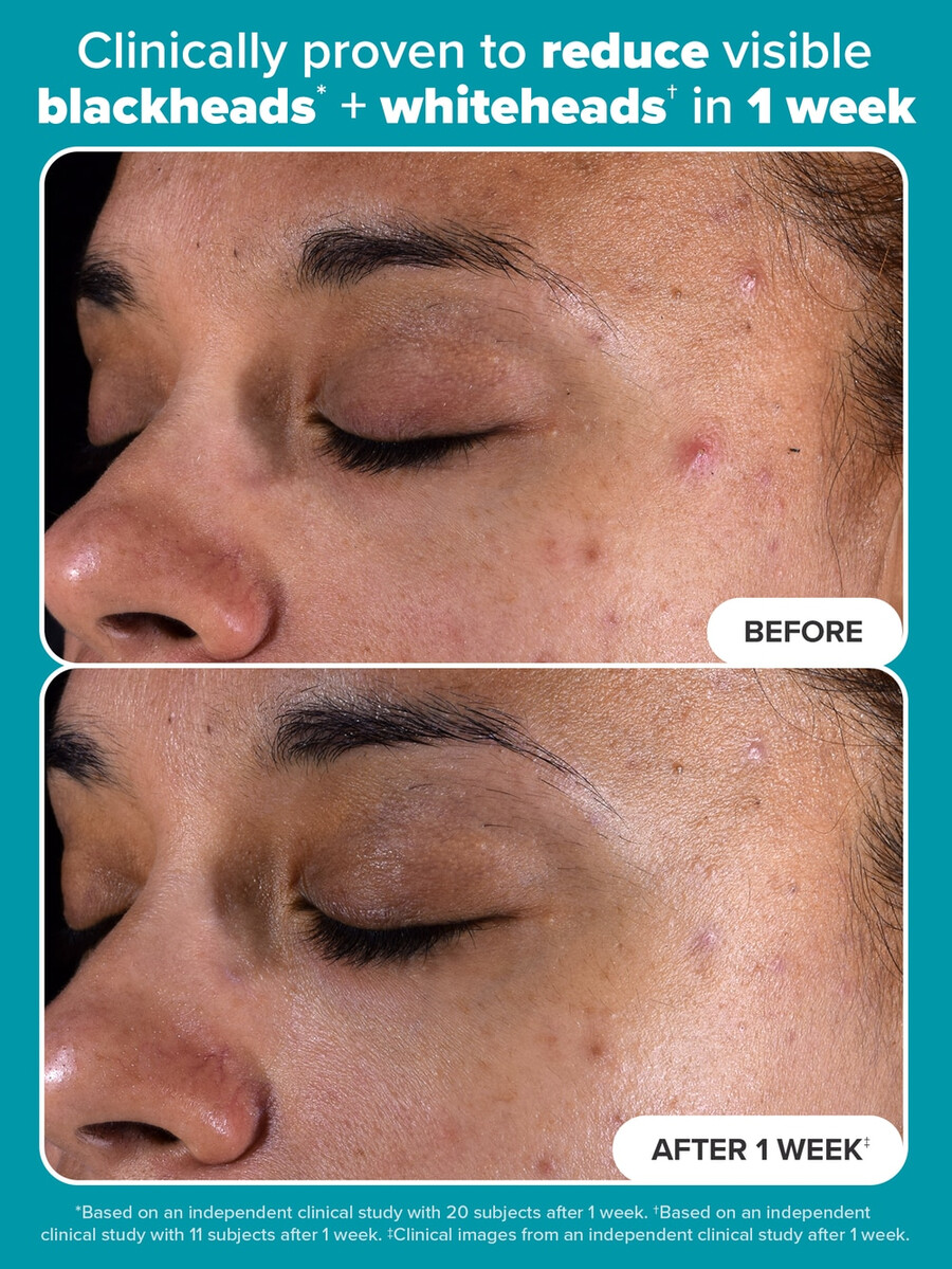 2 bha exfoliërende toner pads