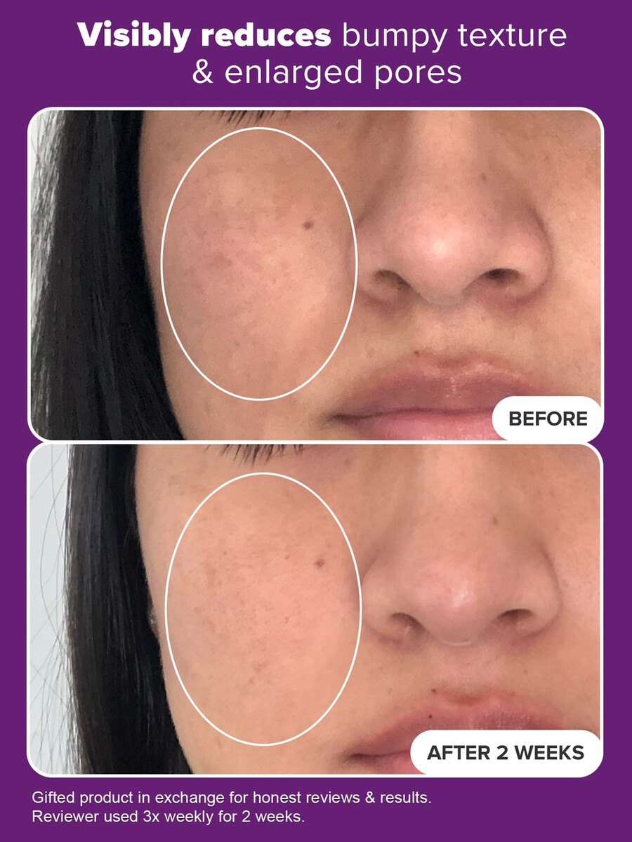 klinische behandeling met 20 niacinamide serum