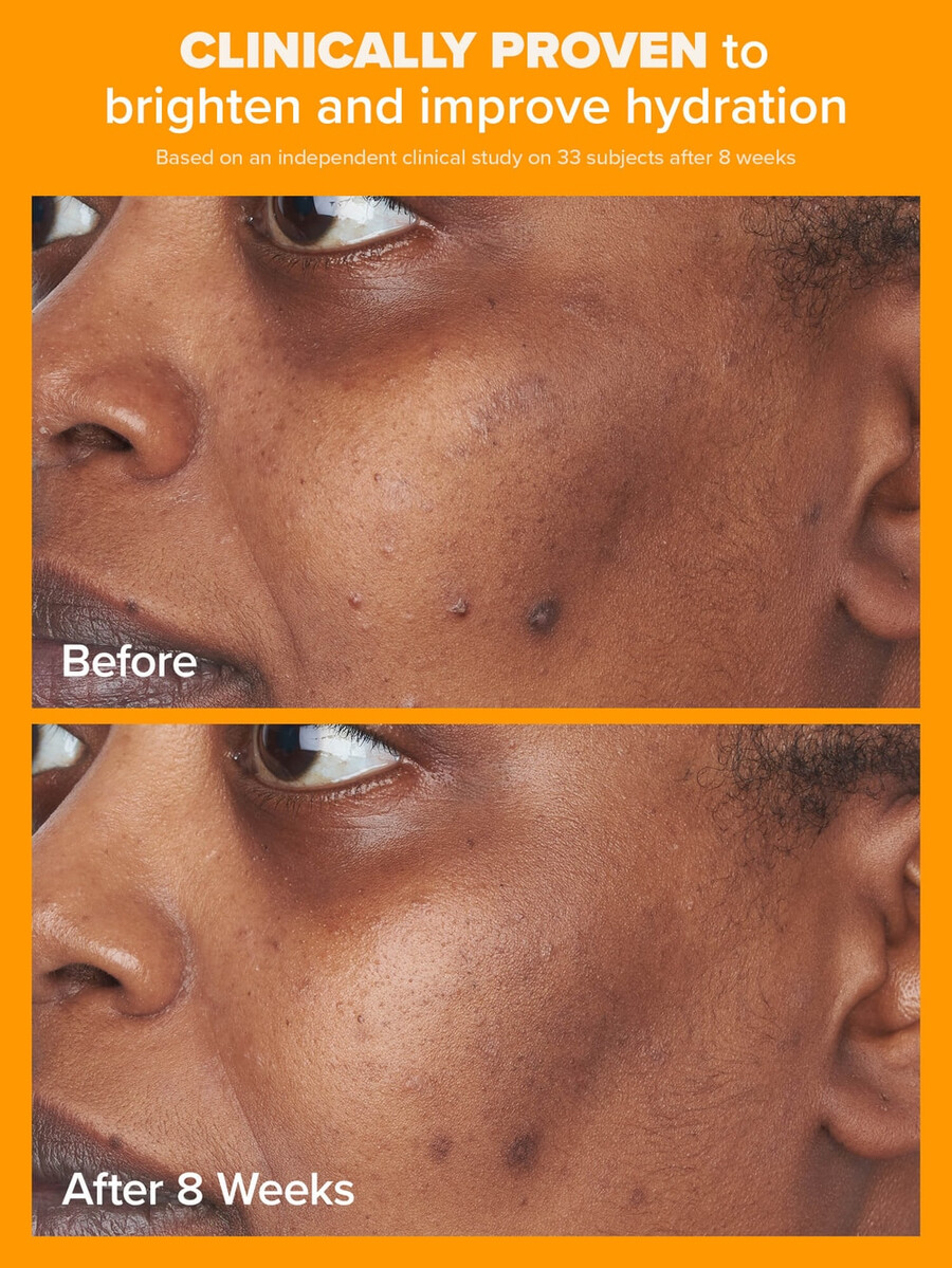 5 vitamine c lichte hydraterende crème met spf 50