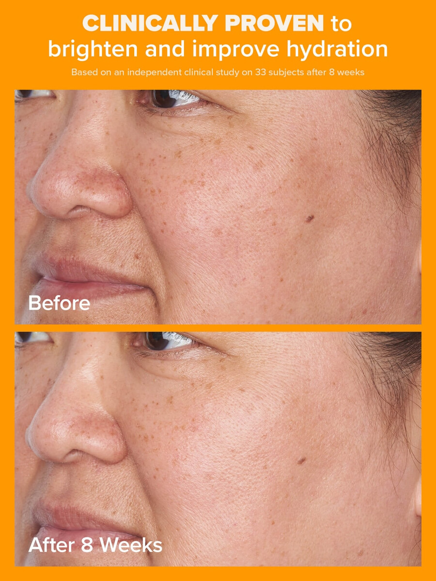 5 vitamine c lichte hydraterende crème met spf 50